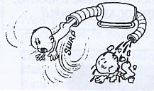 AbortoAspirazione.jpg